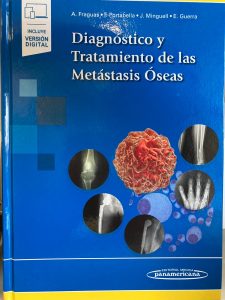 Diagnóstico y tratamiento de las metástasis óseas