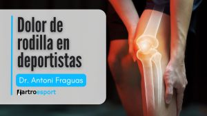 Dolor de rodilla en deportistas