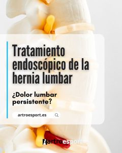 Tratamiento endoscópico de la hernia lumbar